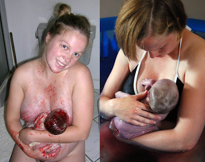 Pregnant Women Giving Birth To A Baby